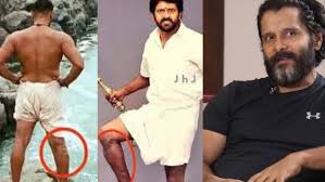 മൂന്നു വര്‍ഷം ഒരേ കിടപ്പ്, 23 ശസ്ത്രക്രിയകള്‍; ഞാൻ ഇനി നടക്കില്ല എന്ന് ഡോക്ടര്‍മാര്‍ വിധിയെഴുതി, പക്ഷേ.: വിക്രം